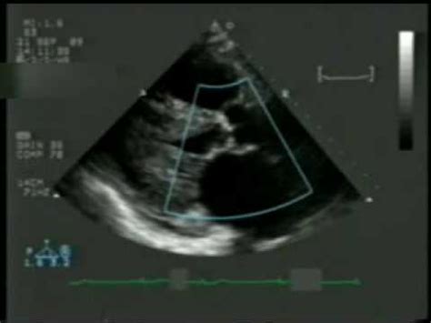 2d echo with doppler|Iba pa.